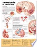libro Entendiendo Que Es Un Derrame / Understanding Stroke Anatomical Chart